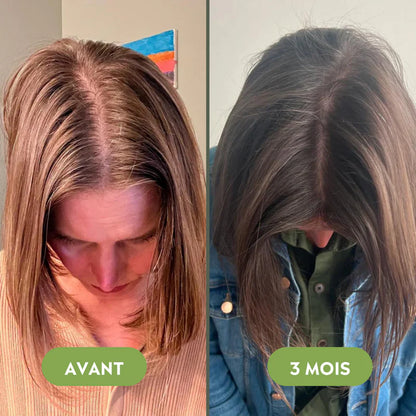 Royal Vital™ Sérum Cheveux 16 Huiles Botaniques