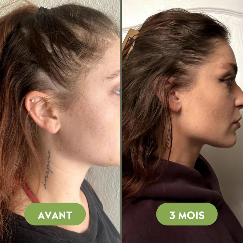 Royal Vital™ Sérum Cheveux 16 Huiles Botaniques