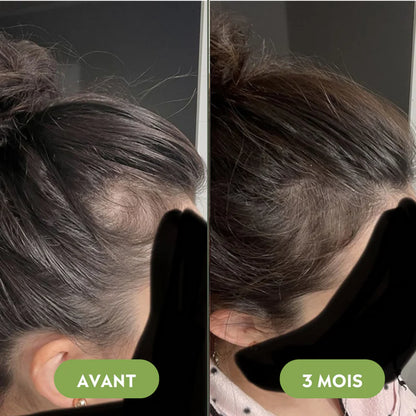 Royal Vital™ Sérum Cheveux 16 Huiles Botaniques