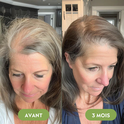 Royal Vital™ Sérum Cheveux 16 Huiles Botaniques