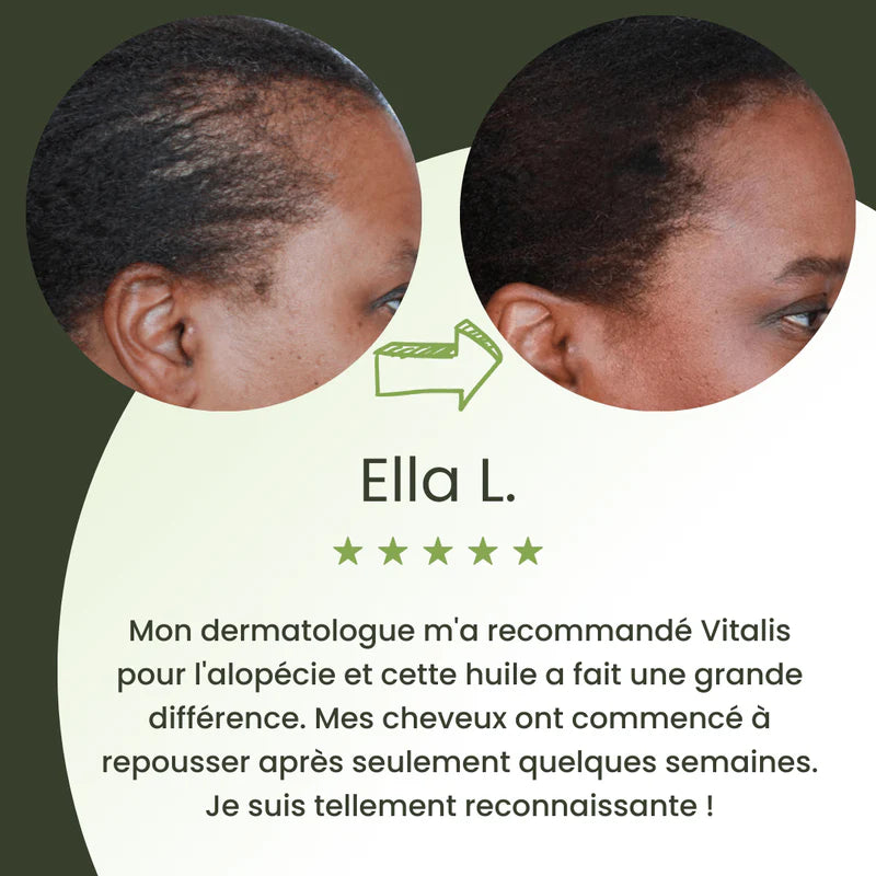 Royal Vital™ Sérum Cheveux 16 Huiles Botaniques