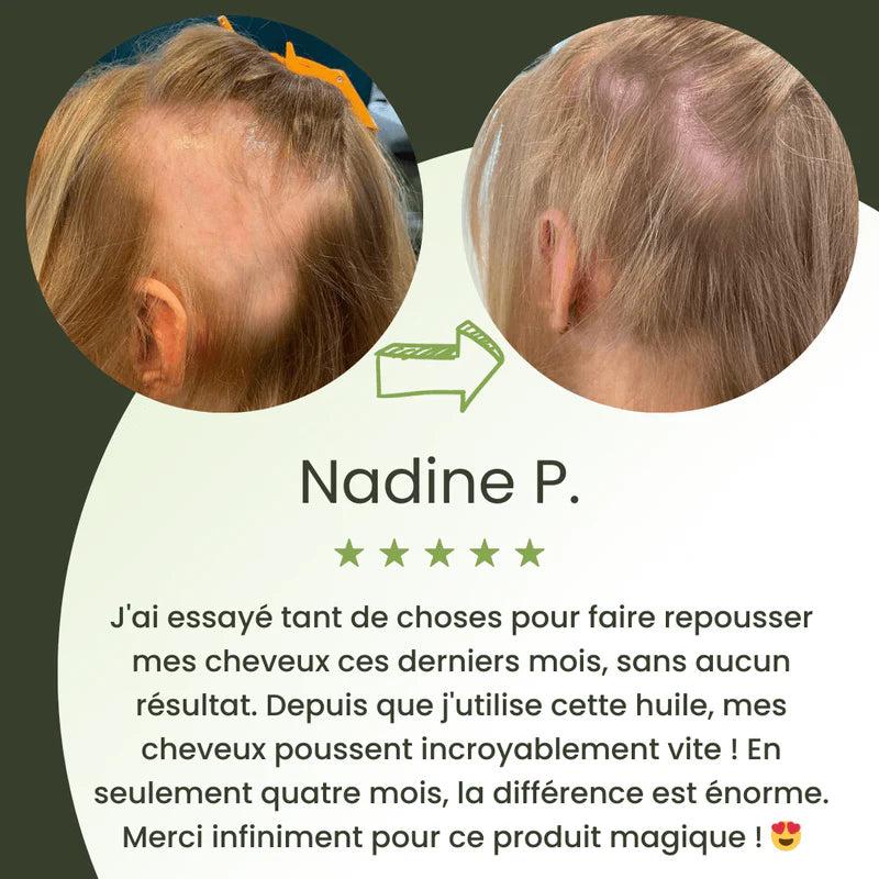 Royal Vital™ Sérum Cheveux 16 Huiles Botaniques