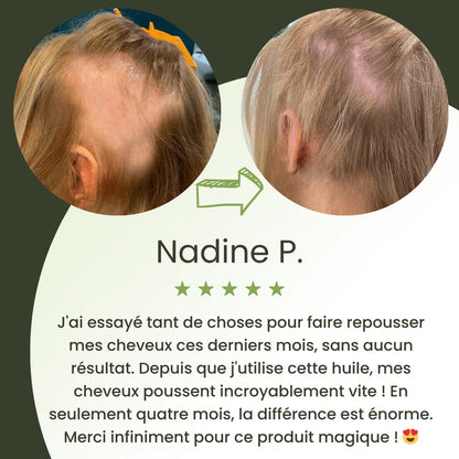 Royal Vital™ Sérum Cheveux 16 Huiles Botaniques